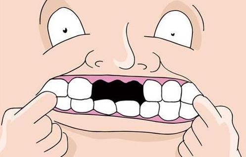 为什么说牙齿缺失会影响寿命？牙齿缺失后如何选择种植牙黄金期?